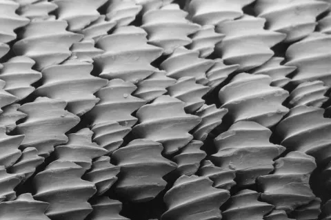 Dermal denticles of a lemon shark viewed through a scanning electron microscope.